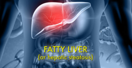 Fatty-liver